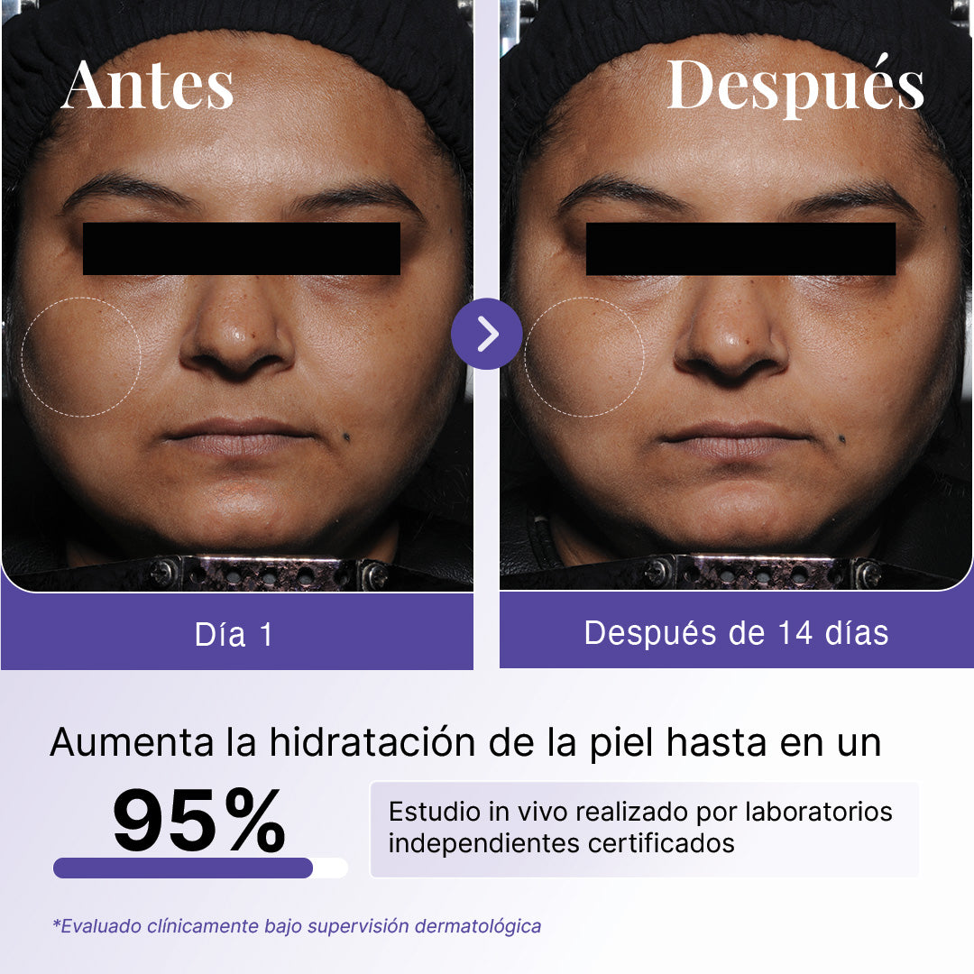 Suero de Ácido Hialurónico 2% con betaína y agua termal del Himalaya
