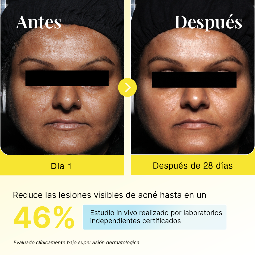 Protector Solar FPS 50 PA++++ con Ectoína + Antioxidantes