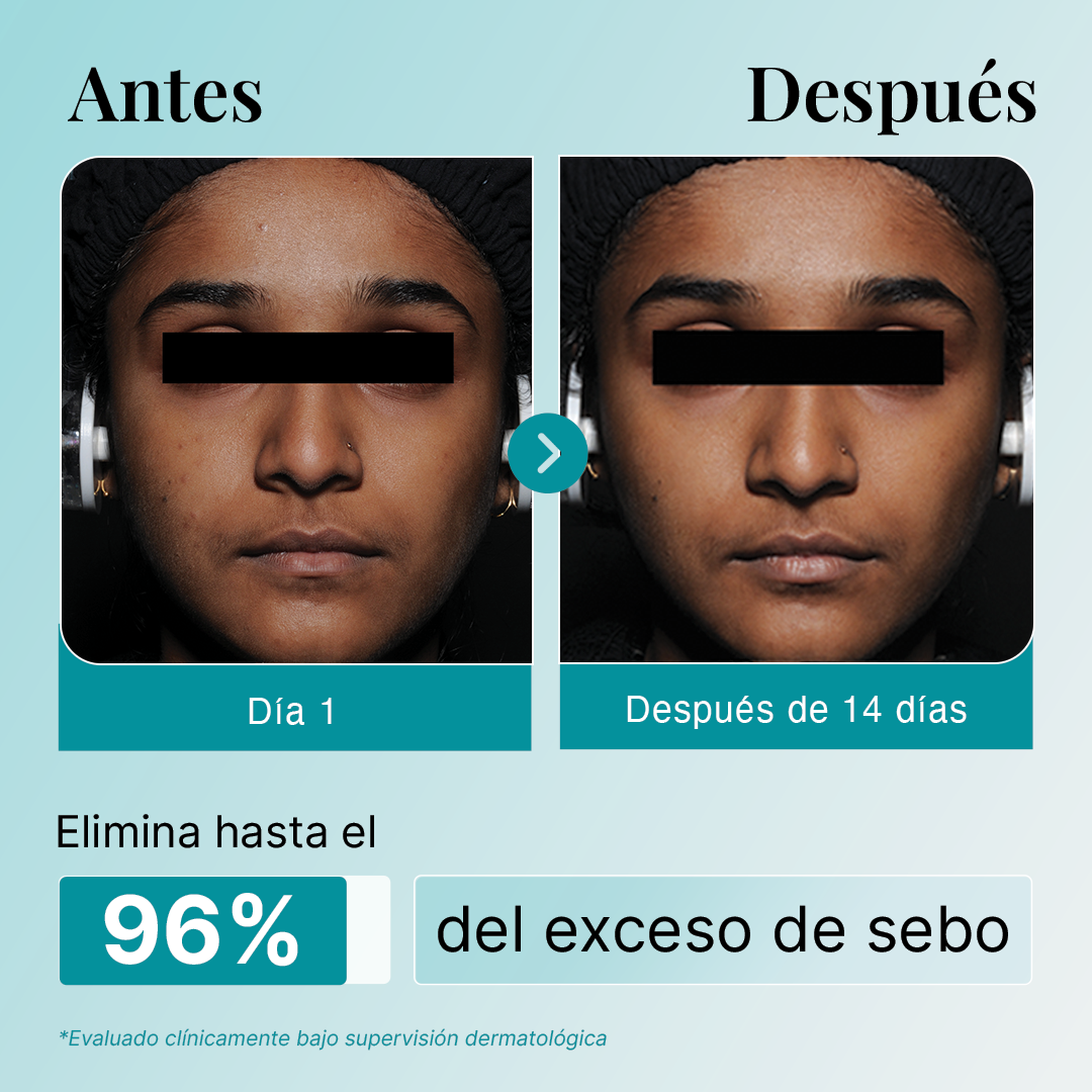 Gel Limpiador con Niacinamida 2% + Ácido Salicílico + Agua Termal del Himalaya