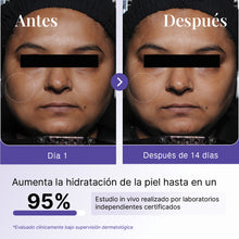 Suero de Ácido Hialurónico 2% con betaína y agua termal del Himalaya