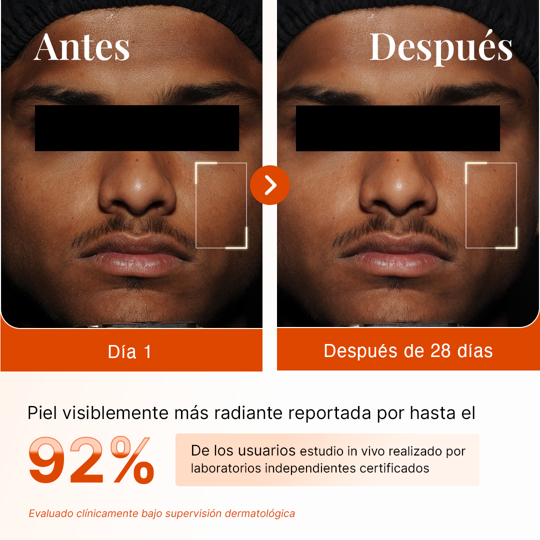 Suero de Vitamina C 15% Con Ácido Hialurónico