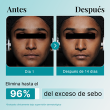 Gel Limpiador con Niacinamida 2% + Ácido Salicílico + Agua Termal del Himalaya
