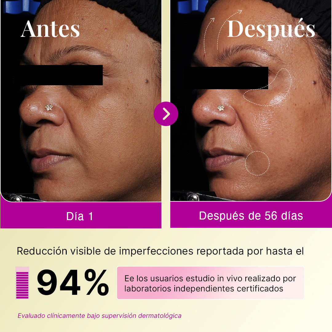 Suero Nocturno de Retinol (0.1% Retinol Encapsulado)