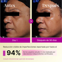 Suero Nocturno de Retinol (0.1% Retinol Encapsulado)